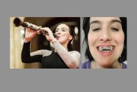 Two photos are shown side by side. The left is of a young woman playing a clarinet at a concert. The right is of the same woman showing her misaligned teeth.
